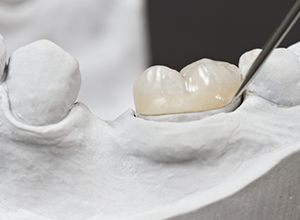 Model of tooth with dental crown