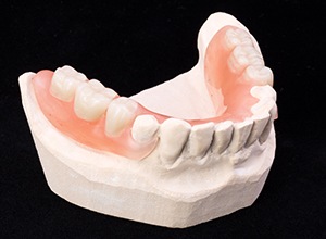 Model teeth with partial denture