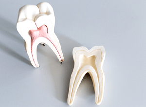Open tooth model against gray background, showing root canals