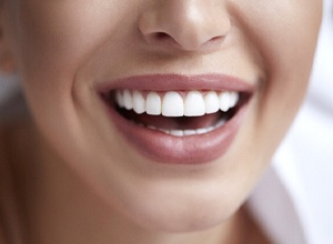 Close-up of woman’s bright, beautiful smile after teeth whitening
