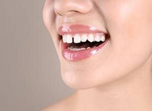 Woman’s smile with gap between the two front incisors